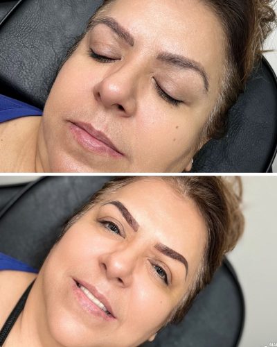 Eye Brows Before After Image